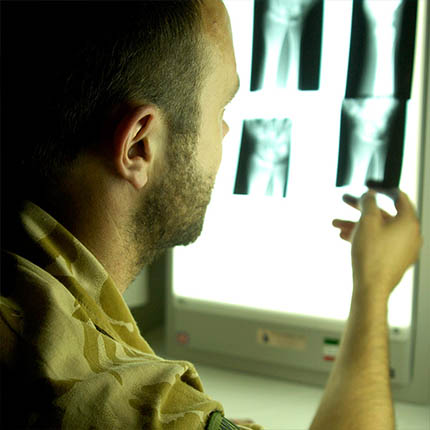 RAF Radiographer studying x-rays on lightbox
